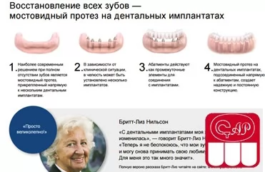 Восстановление всех зубов - системы имплантатов Astra Tech