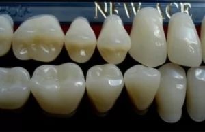 Что такое гарнитурный зуб