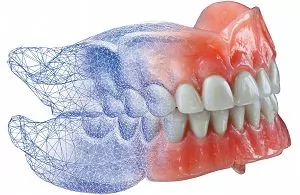 Методика проектирования и визуализации зубных протезов с помощью диагностического воскового моделирования