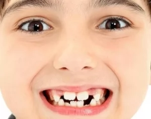 Почему нет зубов у ребенка: главные причины и способы решения проблемы
