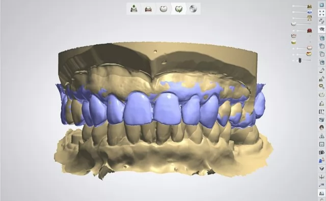 Основные CAD/CAM-модули при изготовлении зубных протезов