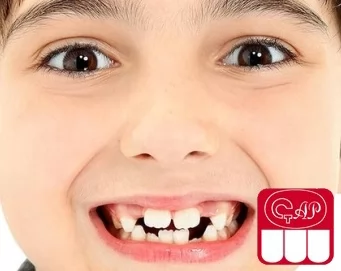 Почему нет зубов у ребенка: главные причины и способы решения проблемы