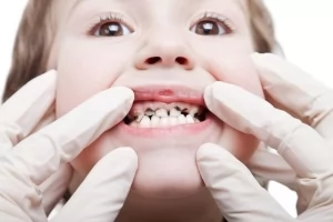 Почему у ребенка плохие молочные зубы