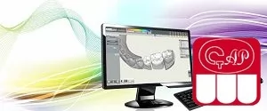 Основные модули и этапы работы CAD/CAM-систем стоматологического назначения