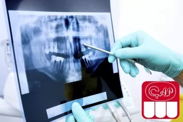 Основные методики рентгенологического исследования в детской стоматологии