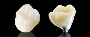 Классификация стоматологической керамики