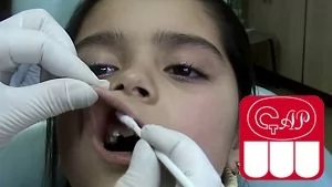 Неинъекционное обезболивание в детской стоматологии