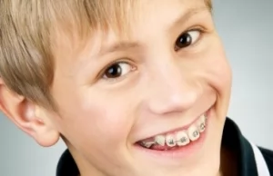 Сколько стоит поставить брекеты на зубы ребенку