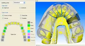 Основные модули и этапы работы CAD/CAM-систем стоматологического назначения