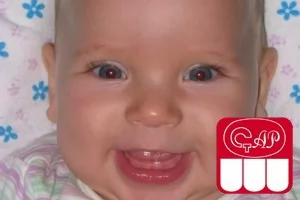 Почему у ребенка в 8 месяцев нет зубов