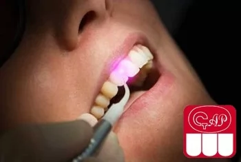 Физиотерапевтические методы лечения периодонтита в детской стоматологии