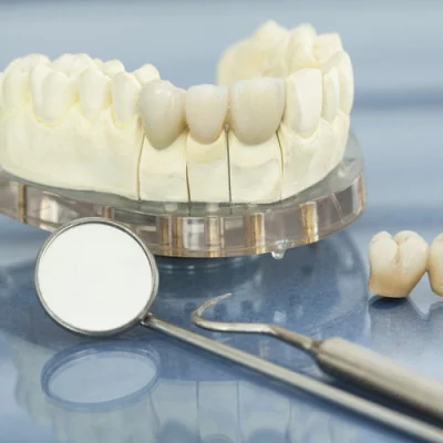 Виды зубных протезов для восстановления размера и формы зубов