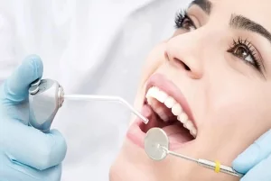 Профессиональная гигиена полости рта – 5 500 руб.