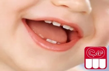 Молочные зубы: удалять или лечить?