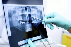 Основные методики рентгенологического исследования в детской стоматологии